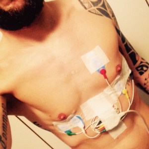 Cavi e adesivi ovunque